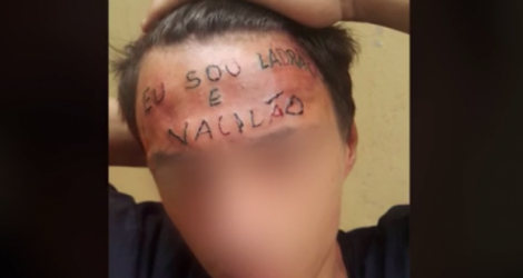 La famille de la victime, inquiète de ne pas avoir eu de ses nouvelles, a découvert avec effroi sur les réseaux sociaux une vidéo des tortionnaires en train de tatouer la phrase sur le front de l'adolescent.