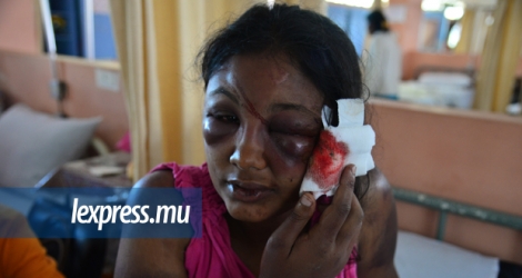 Le visage tuméfié d’Urvashi Joygobhin et ses hématomes sur tout le corps en disent long sur ce qu’elle a vécu hier, mercredi 25 octobre. © Beekash Roopun