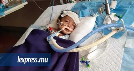 Léa, âgée de 3 mois est aux soins intensifs à l’hôpital  Manipal à Bangalore en Inde.