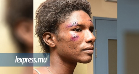Tacha Ti Lamour Dou, connue pour ses lives, a été agressée par un groupe de personne.