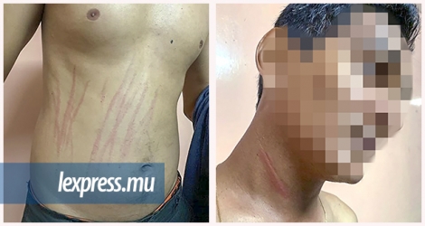 Cet habitant de L’Esperance allègue avoir été malmené par des policiers, le dimanche 8 mars, pour une affaire de drogue, dans laquelle il ne serait aucunement impliqué.