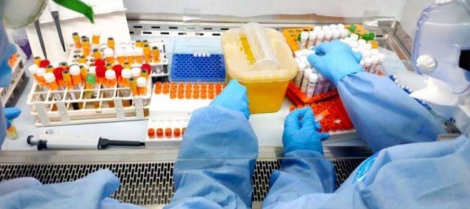Selon plusieurs médecins spécialistes, la fiabilité des tests PCR dépend grandement des échantillons à analyser.