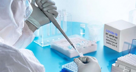Le degré de concordance du test antigène avec le PCR, ou un autre test homologué, permet de savoir s’il est fiable ou pas.