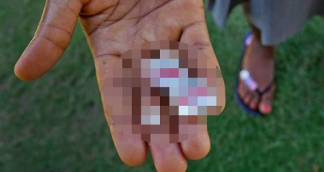 (photo d’illustration, crédit MSF) Le médecin a prescrit des pilules abortives à la fille de 15 ans.