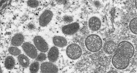 La variole du singe est une maladie infectieuse causée par un virus transmis à l'homme par des animaux infectés. 