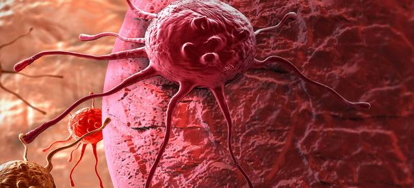 Cancer: découverte d'une molécule qui s'attaque aux mélanomes
