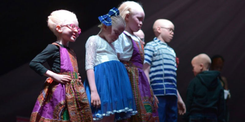 Kenya: un concours de beauté pour albinos pour lutter contre les préjugés