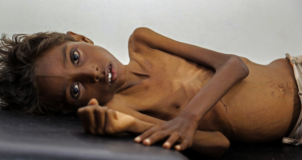 Au Yémen, les deux-tiers de la population peinent à se nourrir (ONU)