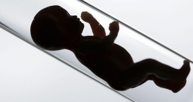 Un utérus artificiel pourrait réduire la mortalité des grands prématurés (étude)