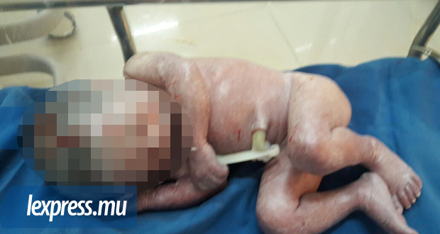  Enceinte de «huit mois», elle se fait avorter dans une clinique