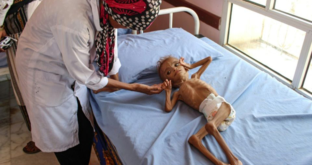 Guerre au Yémen: plus de cinq millions d’enfants menacés de famine