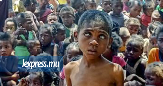 Famine à Madagascar: un peuple en détresse